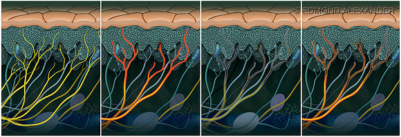 Neuropathic Pain