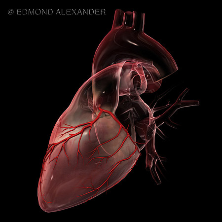 LCA - Left Coronary Artery