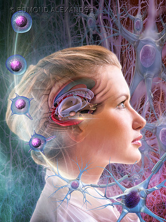 Stem Cell Therapy